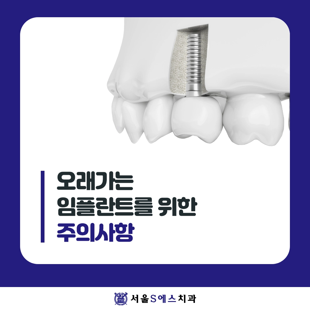 김포 장기동치과 오래가는 임플란트