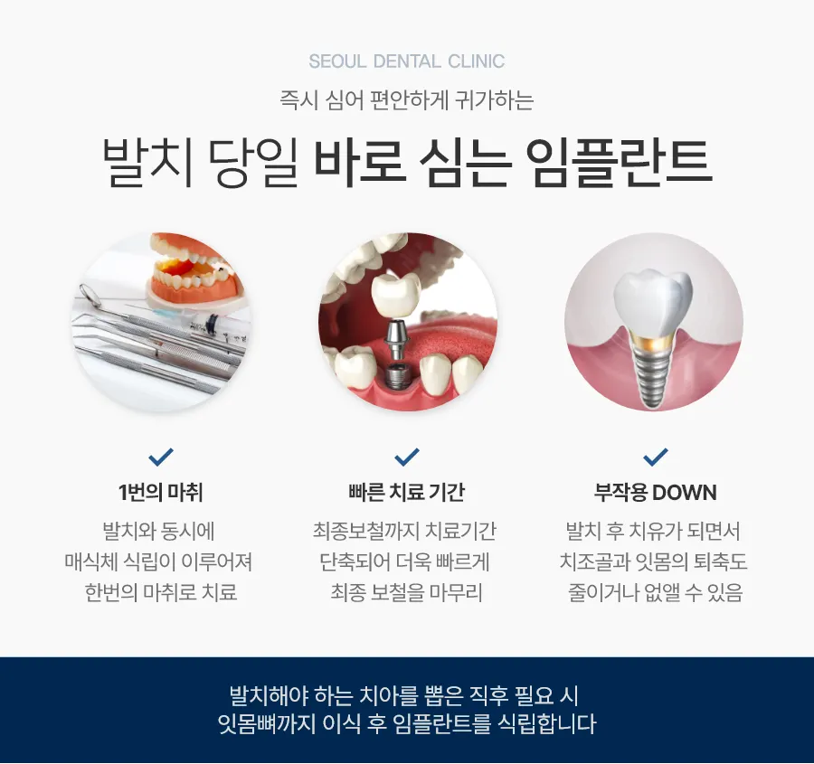 발치 즉시 임플란트