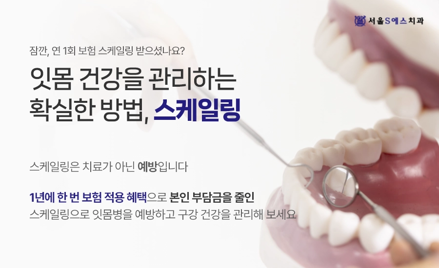 장기동치과 스케일링, 김포스케일링