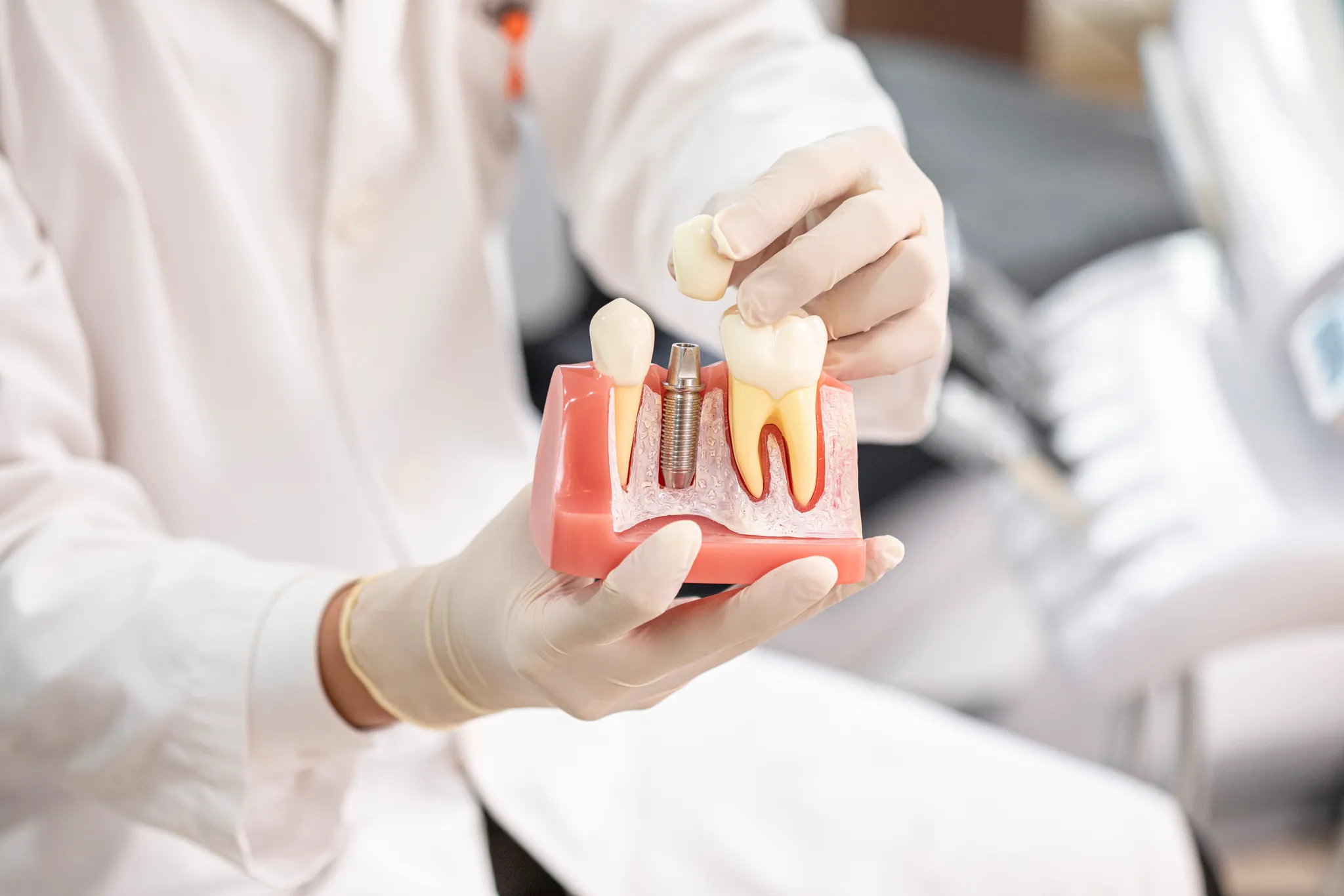 장기동임플란트치과추천 임플란트 부작용이 발생하는 주요 원인