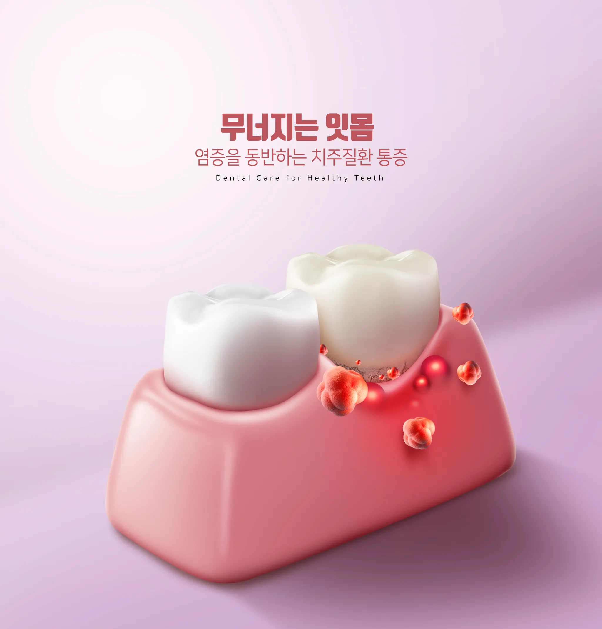 김포치과 잇몸에서 피 난다면? 치주질환 초기 신호와 관리법