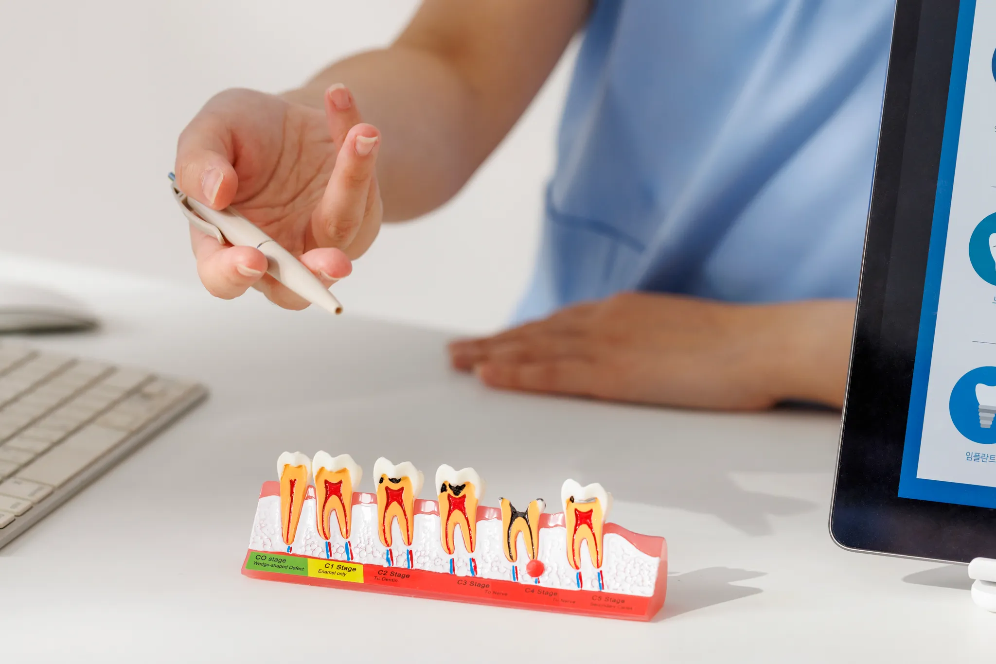 김포치과 선택 전 꼭 알아야 할 충치 치료 시기와 관리 방법
