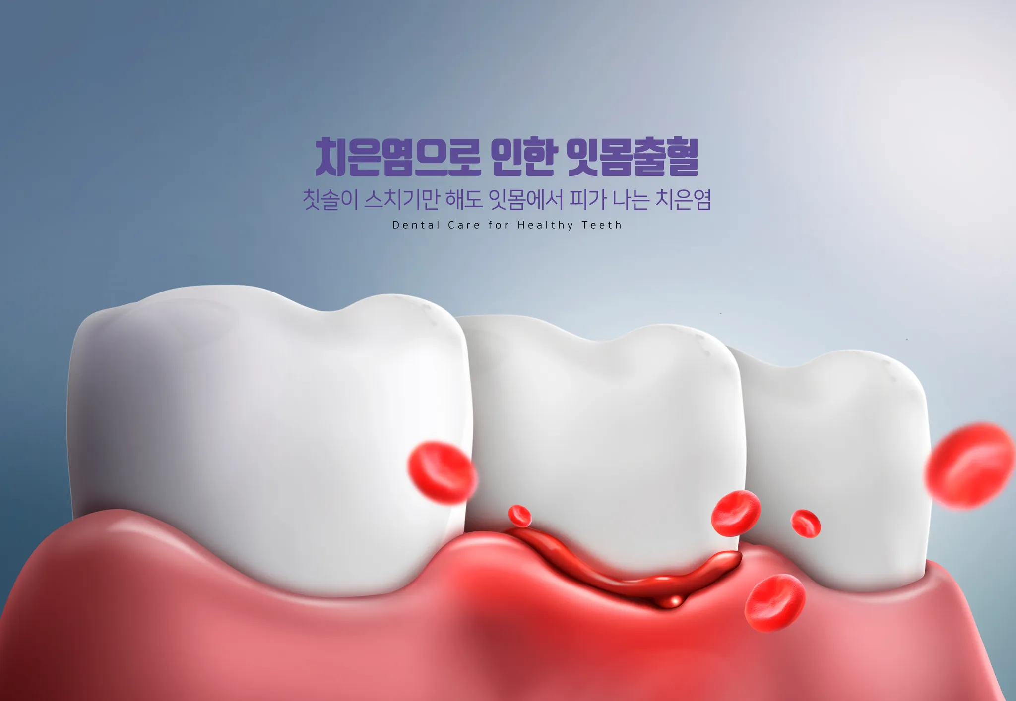 김포치과 잇몸에서 피 난다면? 단순 염증 아닐 수도 있습니다