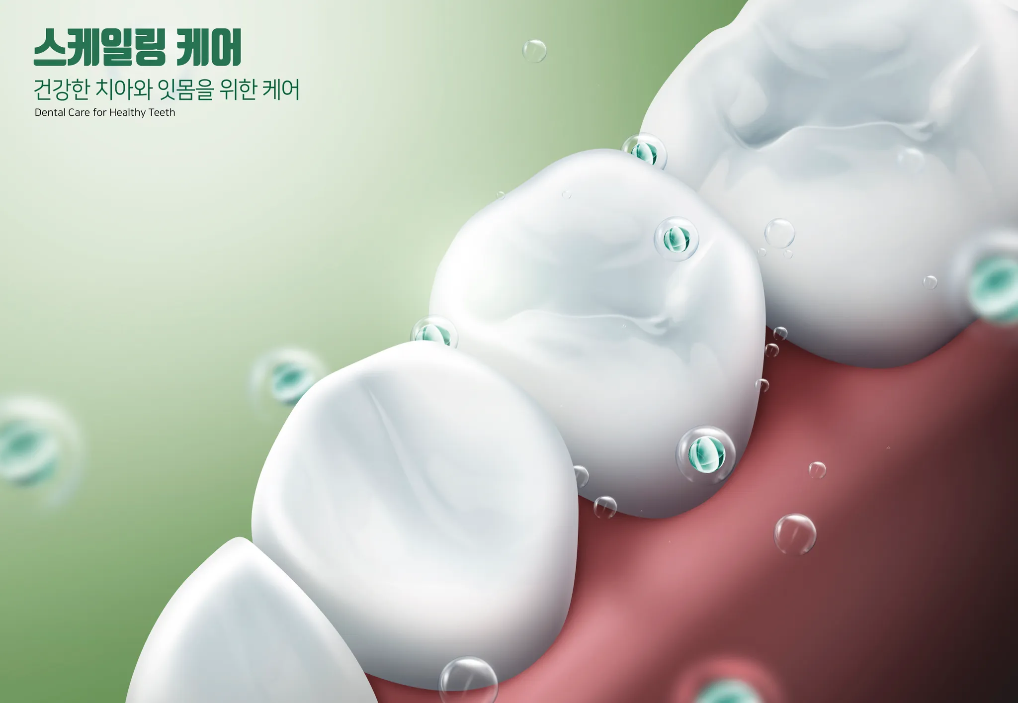 김포치과추천, 스케일링만 잘 받아도 치아를 오래 사용할 수 있는 이유