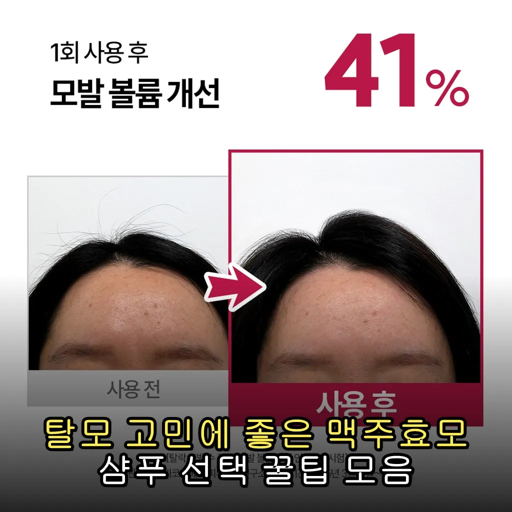 탈모 고민에 좋은 맥주효모 샴푸 선택 꿀팁 모음