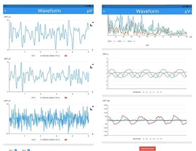 웨어러블 EEG - 전용 앱에서 측정 EEG 표시 장면
